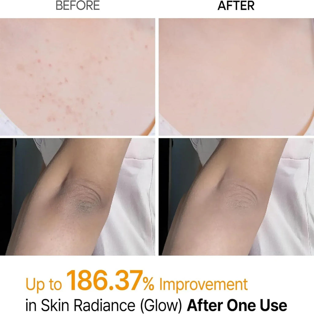 Dr. Melaxin Peel Shot Keratin Boost Spray with Kojic Acid & Turmeric | Korean Skincare