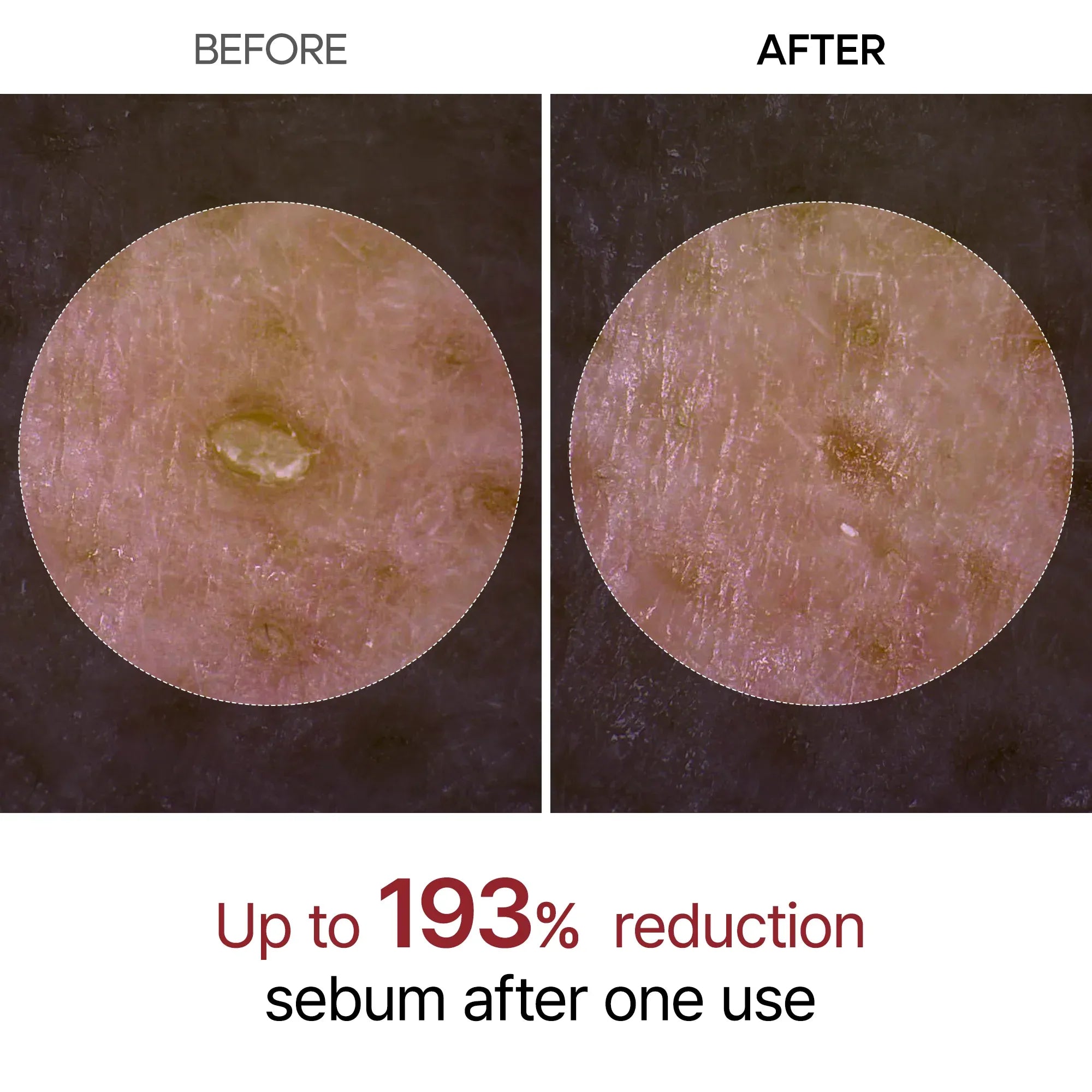 Dr. Melaxin Black Rice Ampoule | Korean Exfoliating Serum for Blackheads