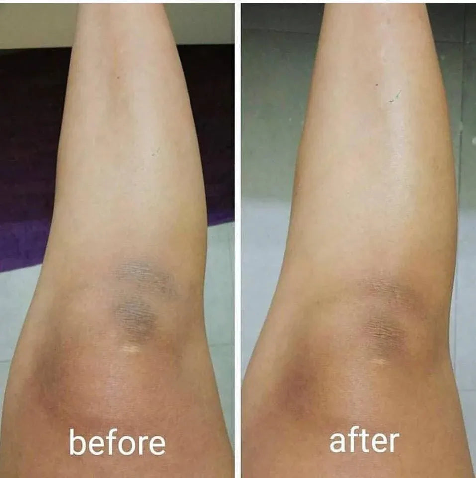 Dr. Melaxin Peel Shot Keratin Boost Spray with Kojic Acid & Turmeric | Korean Skincare