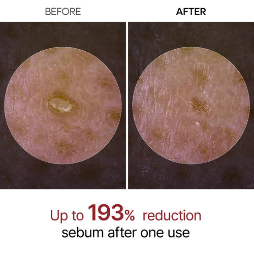 Dr. Melaxin Black Rice Ampoule before and after skin appearance