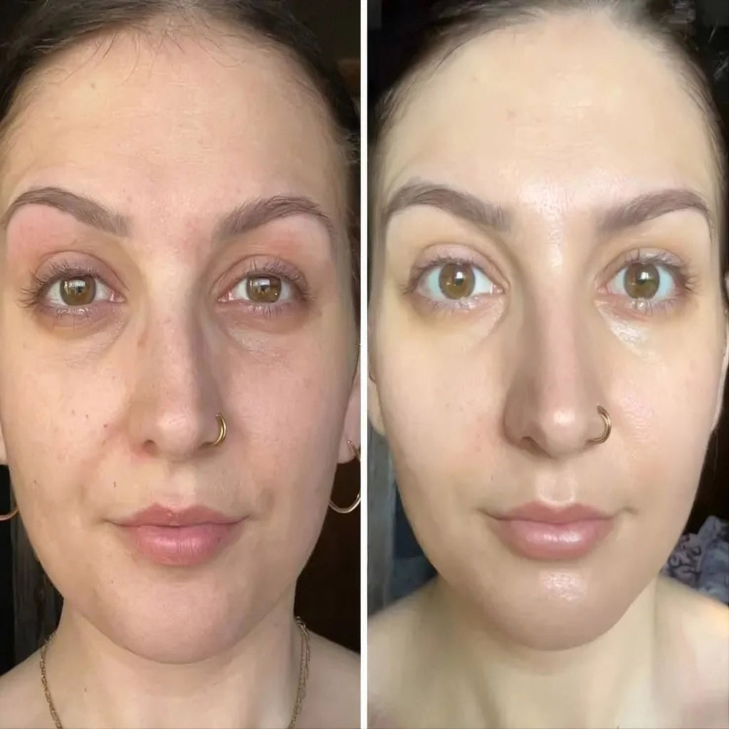Dr. Melaxin Peel Shot Glow Set | Korean Skincare Brightening Kit