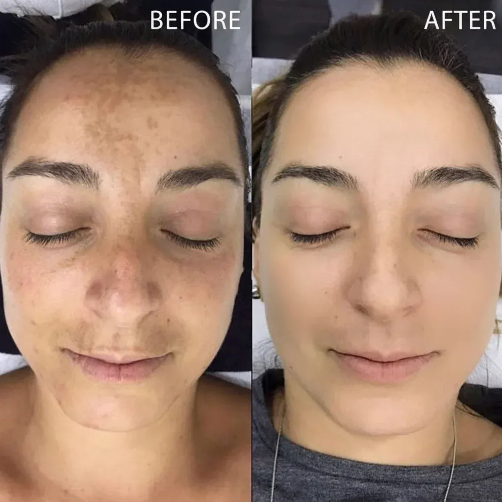 Dr. Melaxin Peel Shot Glow Set | Korean Skincare Brightening Kit